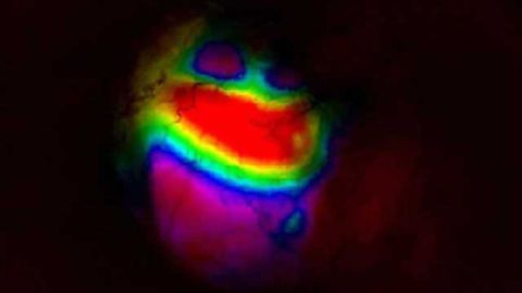 Live-imaging technique for mice seen as boost to studies of brain function and development