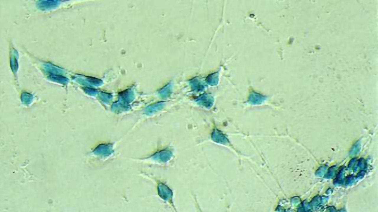 Neuroscientists document first steps in stem cell differentiation