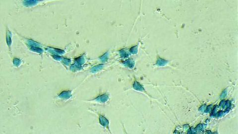Neuroscientists document first steps in stem cell differentiation