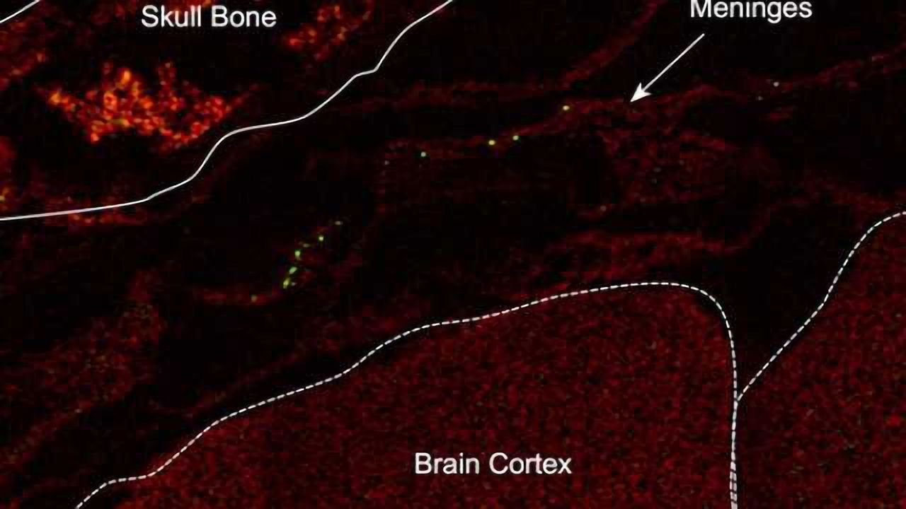 GI tract bacteria help decrease stroke