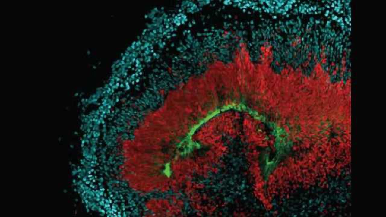 Why neural stem cells may be vulnerable to Zika infection