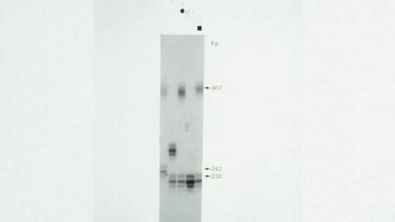 Team finds method to reduce accumulation of damaging Huntington's disease protein