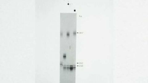 Team finds method to reduce accumulation of damaging Huntington's disease protein