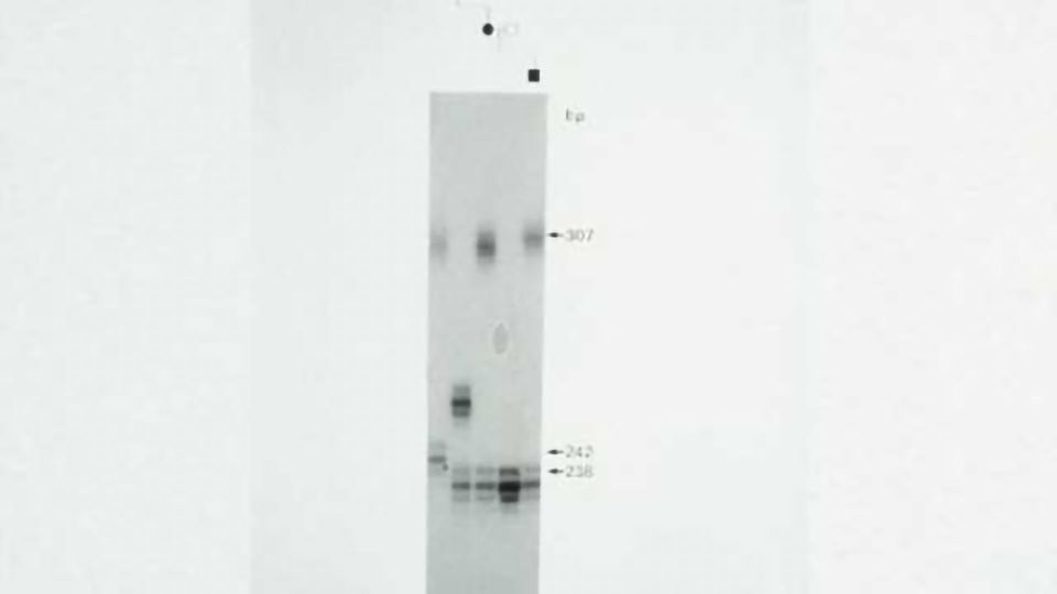 Team finds method to reduce accumulation of damaging Huntington's disease protein content piece image
