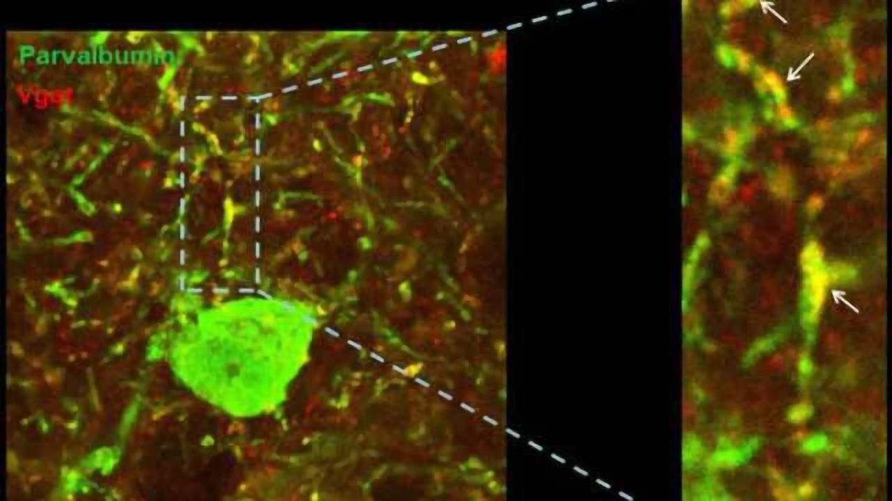 Rhythm of oscillations in cerebral cortex, key to understanding Down syndrome