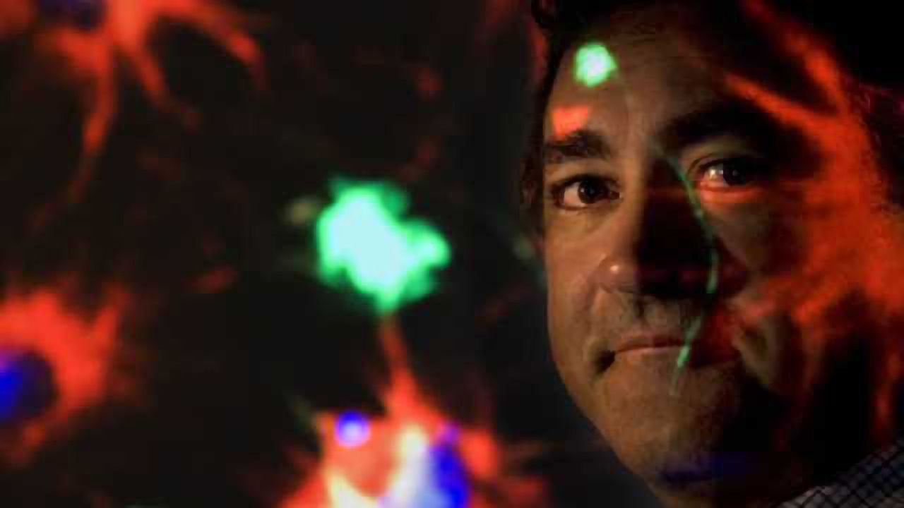 Study finds safer stem cell-derived therapy for brain radiation recovery