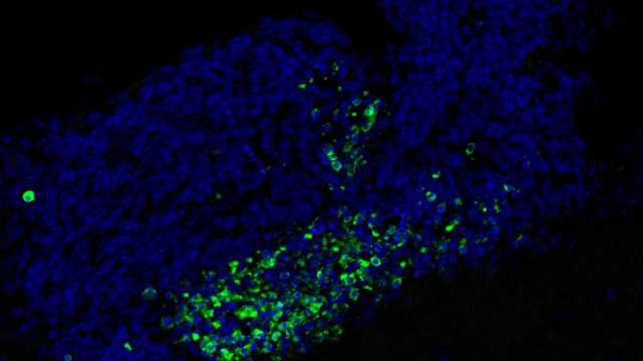 Brain guardians remove dying neurons