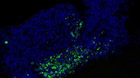 Brain guardians remove dying neurons