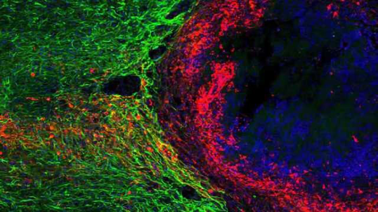 New role identified for scars at the site of injured spinal cord