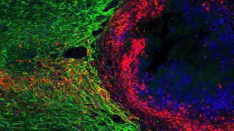 New role identified for scars at the site of injured spinal cord