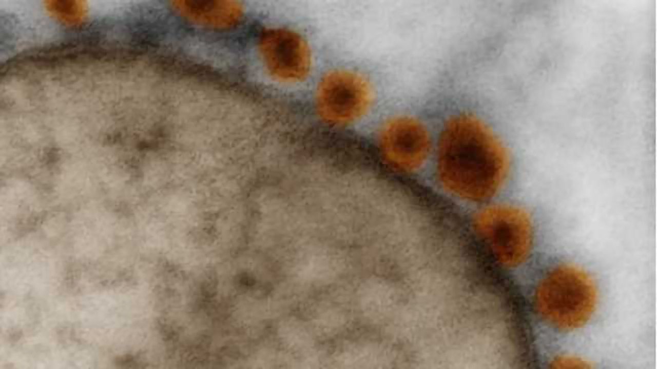 Zika virus tested in brain precursor cells
