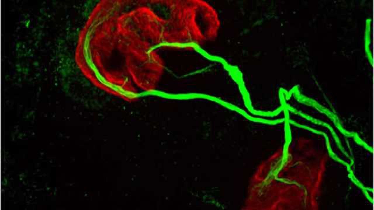 Same immune-system proteins may first giveth, then taketh away motor control