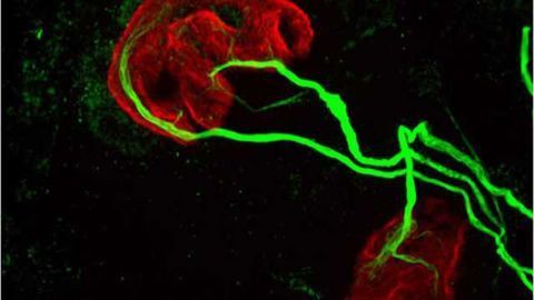Same immune-system proteins may first giveth, then taketh away motor control