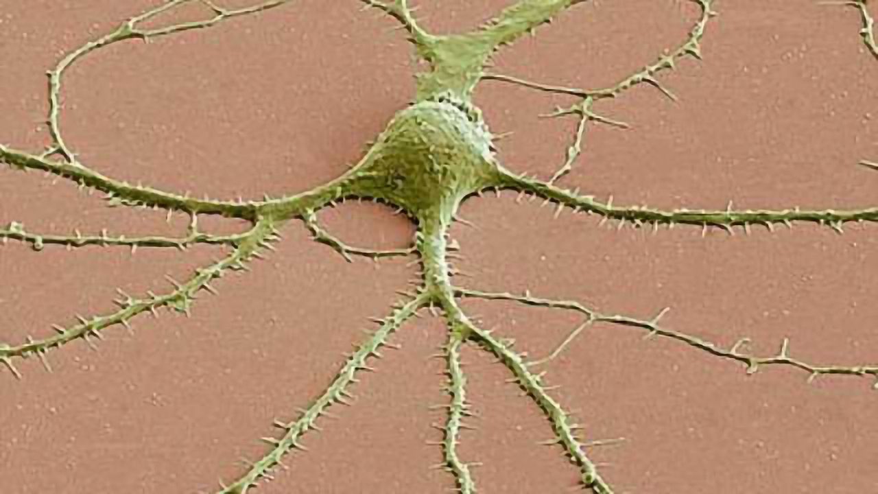 Dysfunctional endosomes are early sign of neurodegeneration