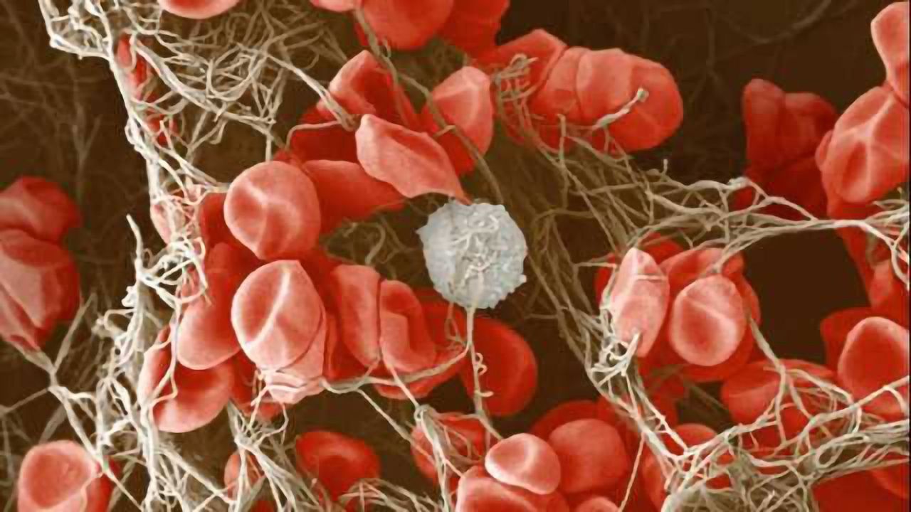 Immune cells help the brain to self-heal after a stroke