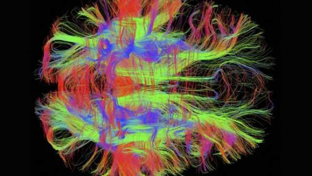 Reduced brain connectivity in frontal cortex linked to propofol-induced loss of consciousness