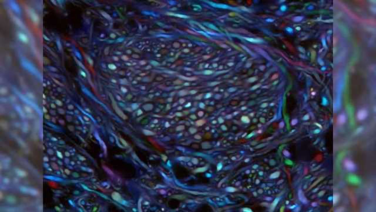 Mapping neurons to improve the treatment of Parkinson's