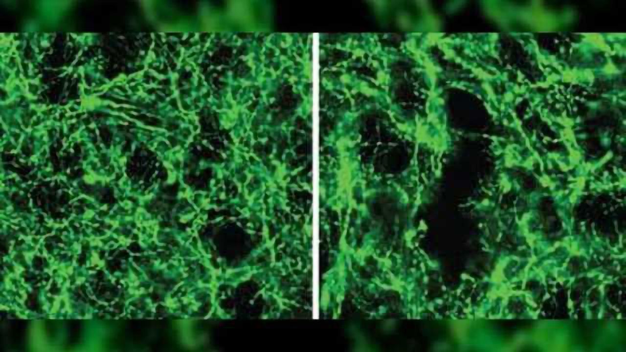 Researchers more accurately define role of dopamine neurons in movement