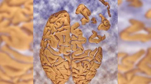 Brain signals between seizures may explain memory problems in patients with epilepsy