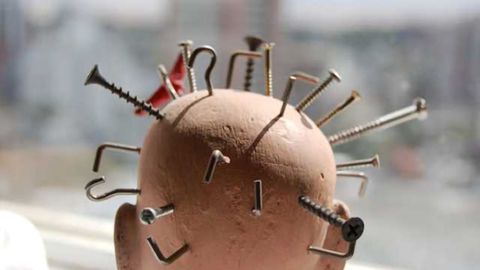 Surgery for chronic temporal headaches—simplified approach shows good results