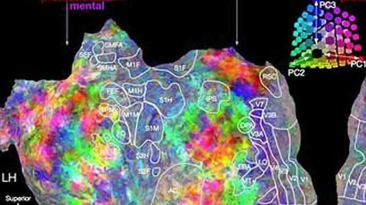 Scientists map brain's 'thesaurus' to help decode inner thoughts