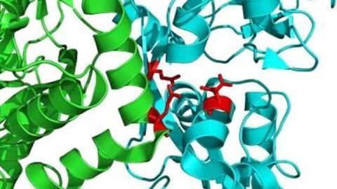 Finding sheds light on what may kill neurons after stroke