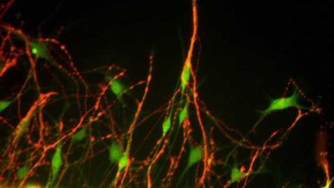 Origin of synaptic pruning process linked to learning, autism and schizophrenia identified