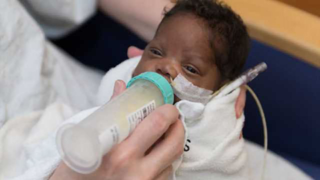 Breast milk linked to significant early brain growth in preemies