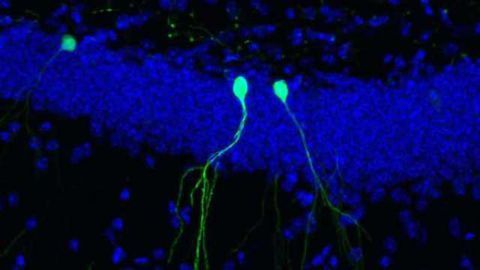 Adult brain prunes branched connections of new neurons