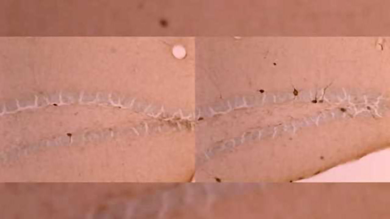 Early life stress accelerates maturation of key brain region in male mice