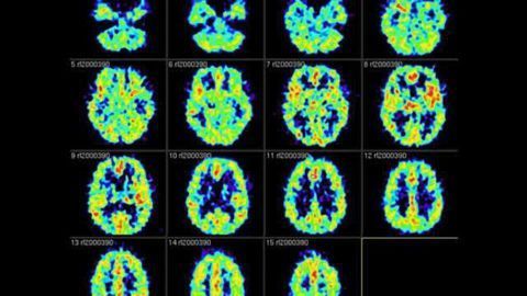 Come to think of it or not: Study shows how memories can be intentionally forgotten