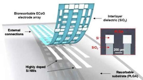 Animal study shows flexible, dissolvable silicon device promising for brain monitoring