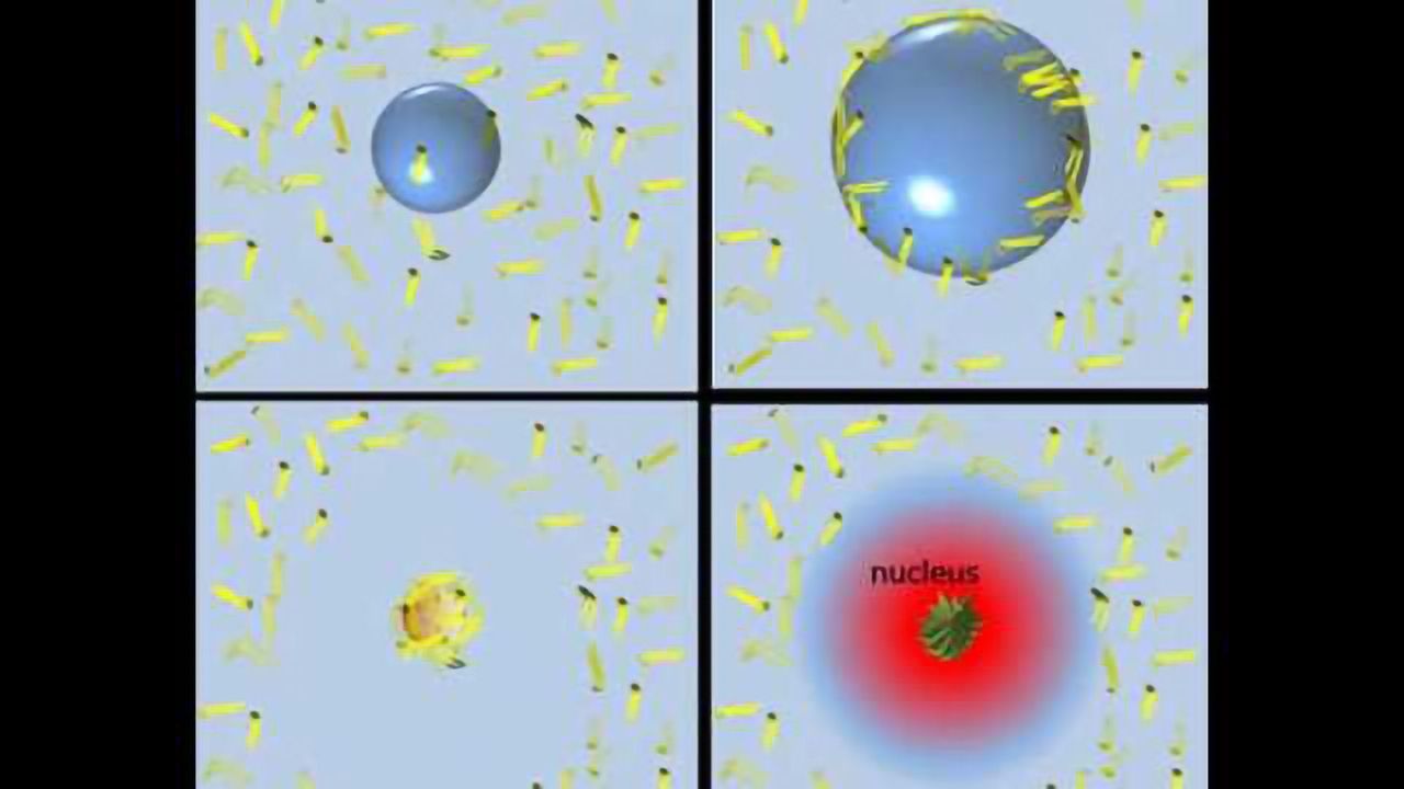 Clue for development of diagnosis, treatment Alzheimer's disease