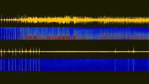 Study suggests new treatment for seizures