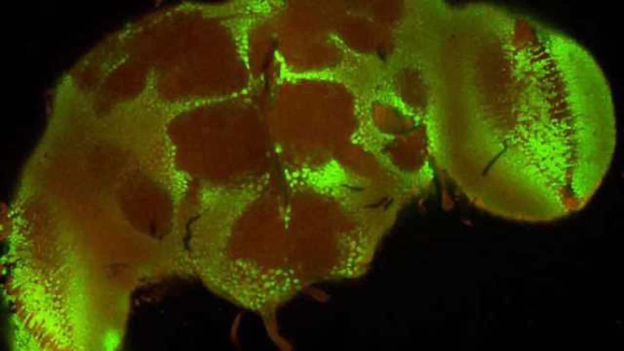 Could flies help us understand brain injuries?
