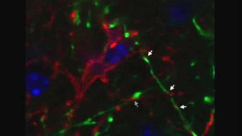 Brain cells that aid appetite control identified