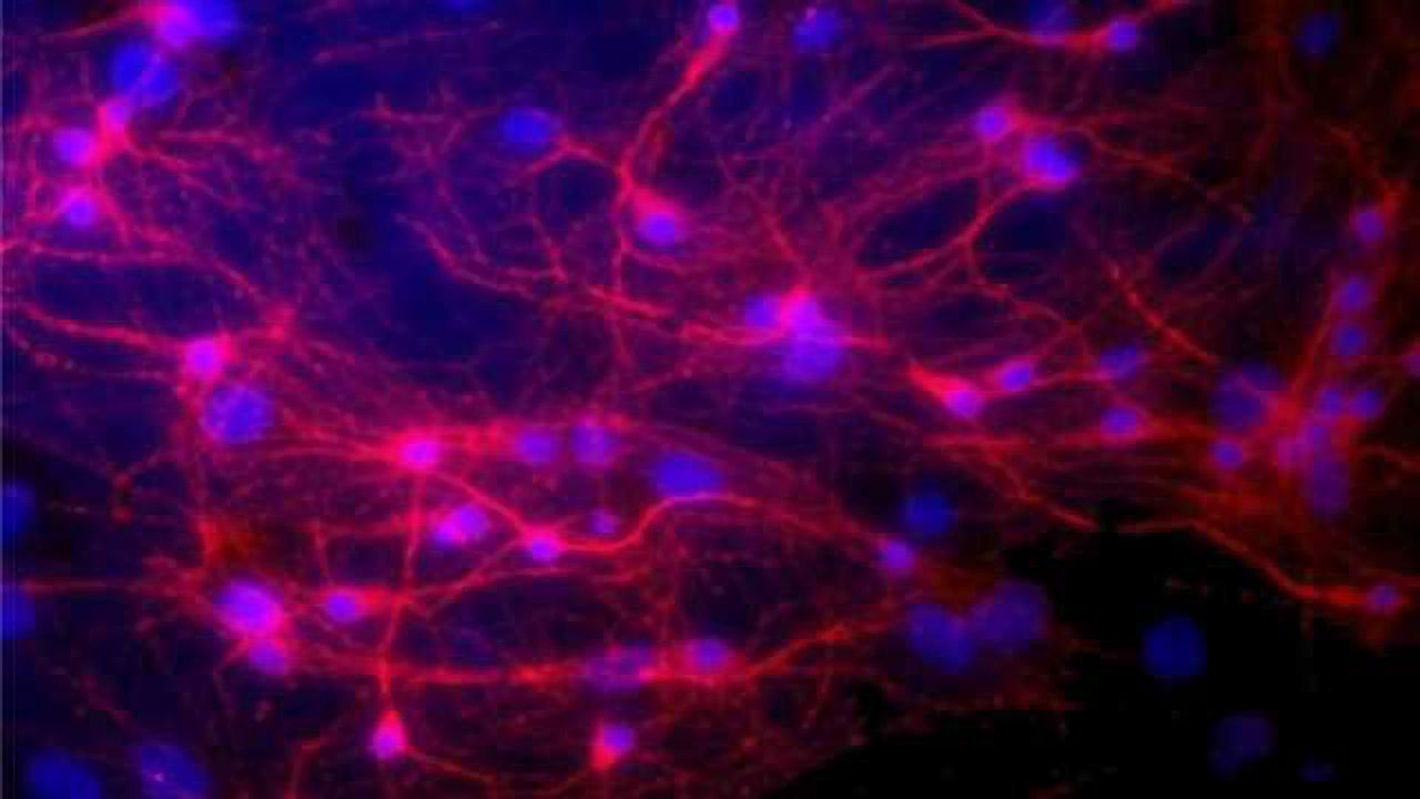 Graphene flakes to calm synapses