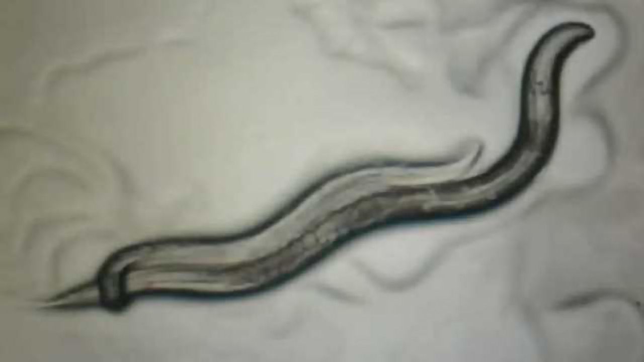 Study reveals how differences in male and female brains emerge in C. elegans