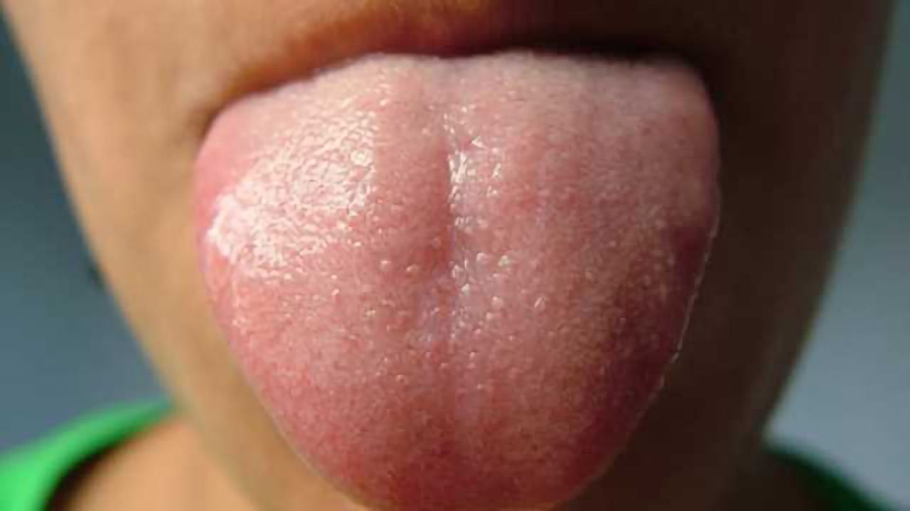 Obese or anorexic individuals react differently to taste, study finds
