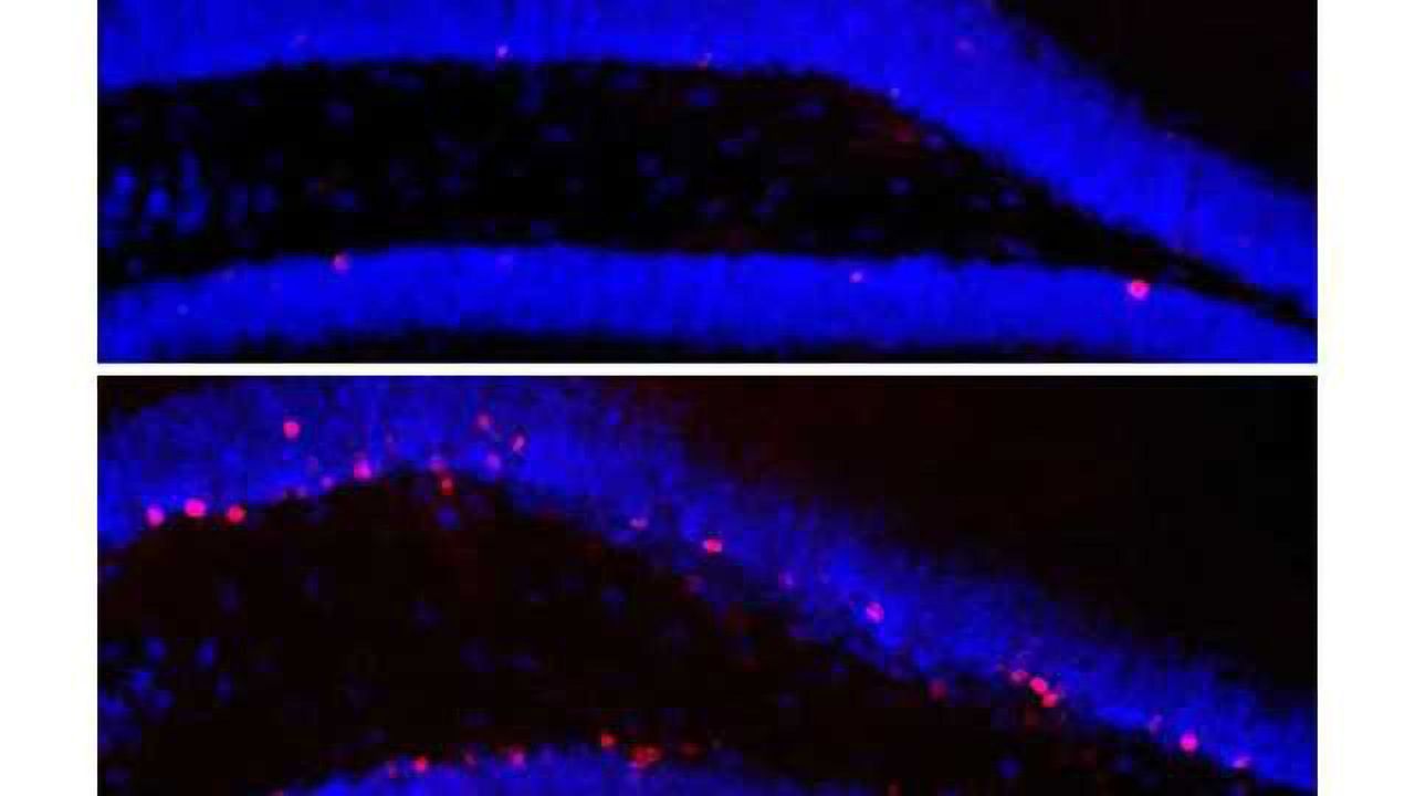 Healthy intestinal flora keeps the mind sharp—with some help from the immune system