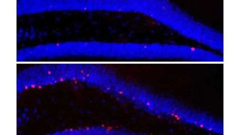 Healthy intestinal flora keeps the mind sharp—with some help from the immune system