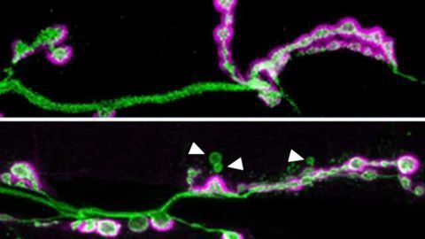 Neuroscientists illuminate role of autism-linked gene