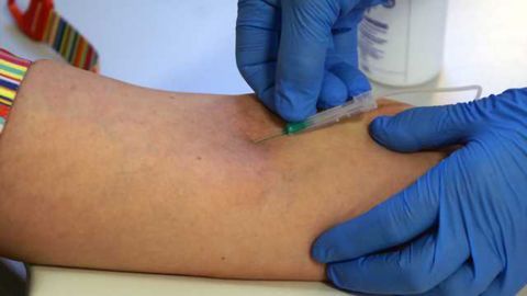 Progranulin and dementia -- a blood sample does not tell the full story