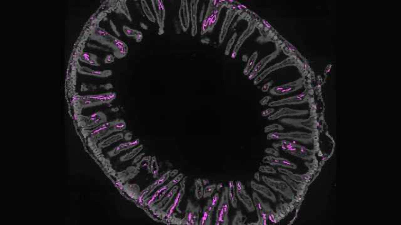 Gut Feelings - Sensory neurons detect fullness and nutrients in the GI tract in surprising ways