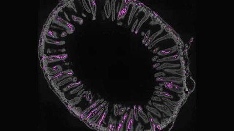 Gut Feelings - Sensory neurons detect fullness and nutrients in the GI tract in surprising ways