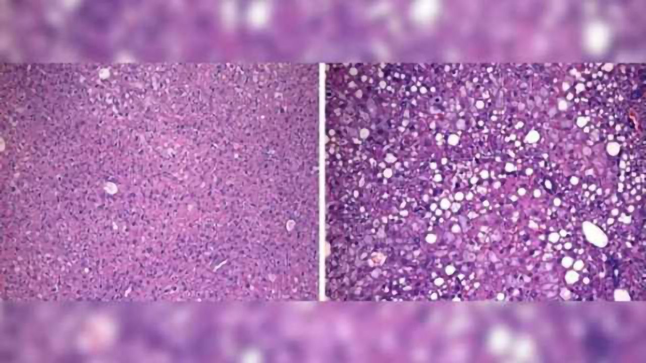 Scientists discover protein that controls the strength of body's circadian rhythms