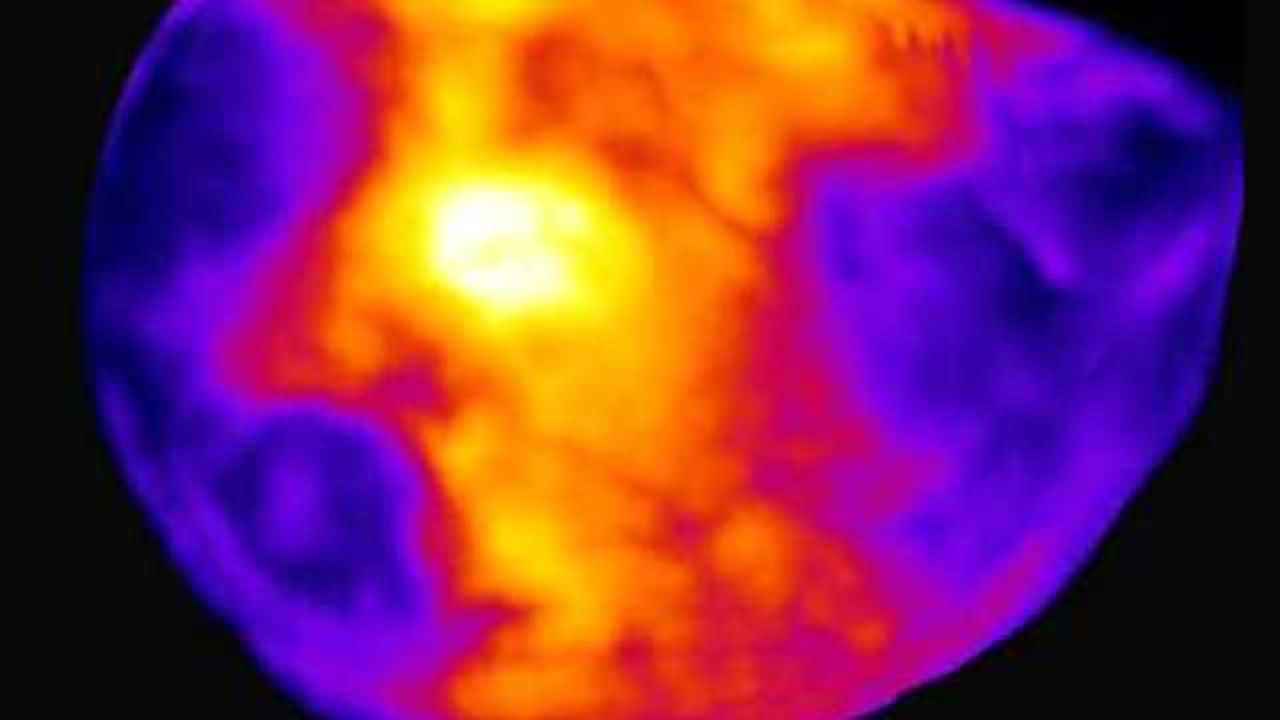 New technique captures the activity of an entire brain in a snapshot