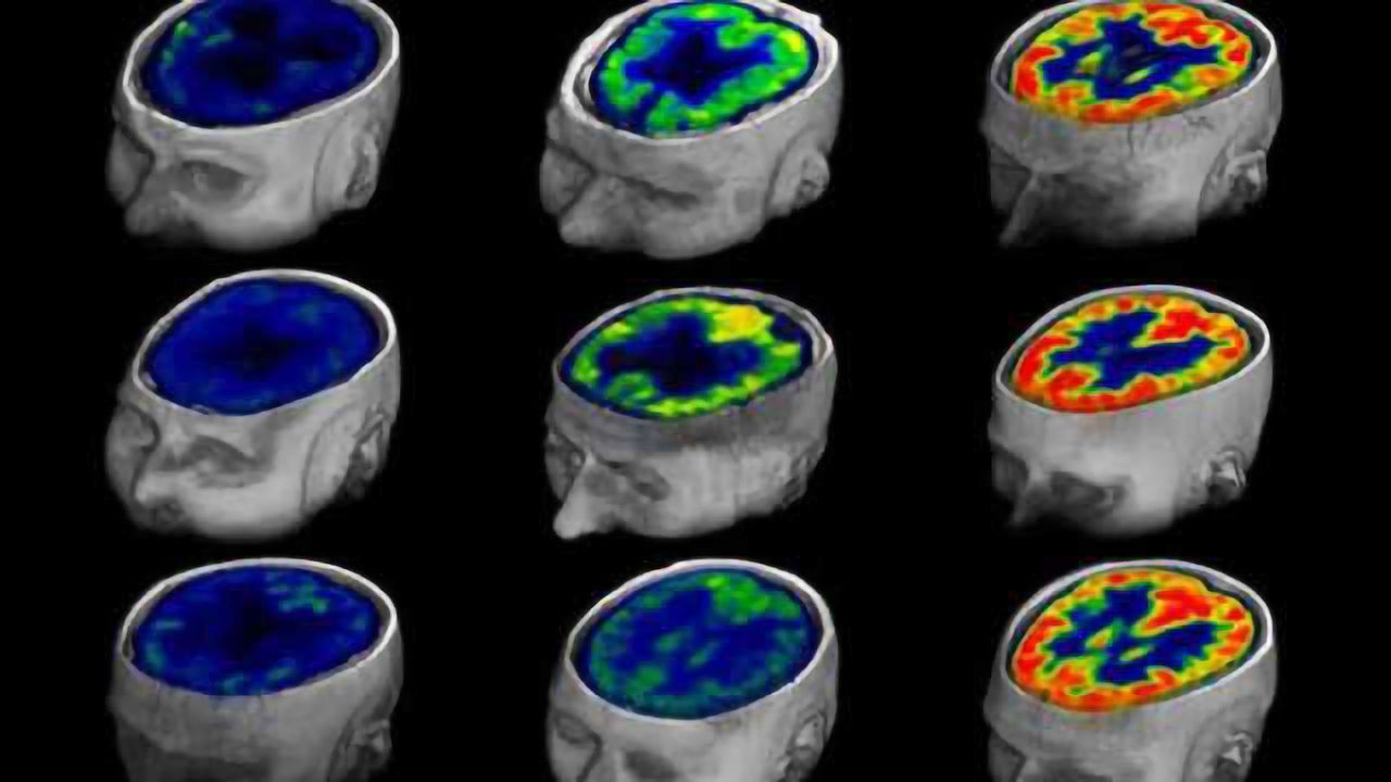 Method for measuring awareness or its impending return in brain-injured patients