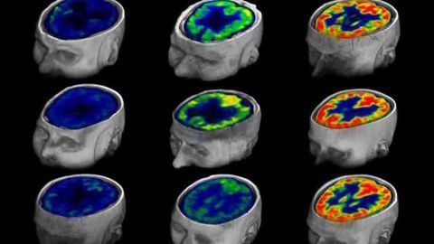 Method for measuring awareness or its impending return in brain-injured patients