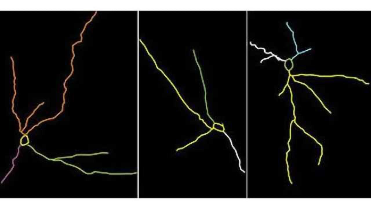 Researchers find new signs of stress damage in the brain, plus hope for prevention